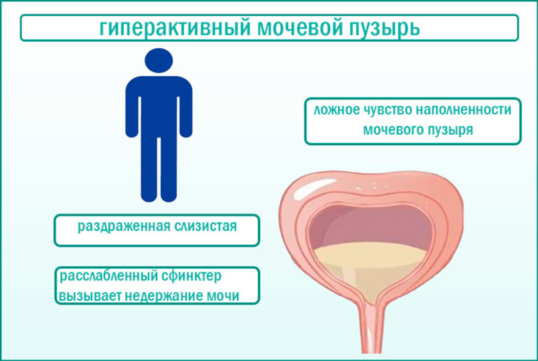 Заболевания мочевыделительной системы