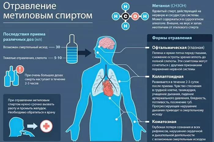 Отравление метиловым спиртом