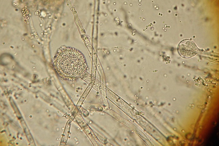 Мукор под микроскопом