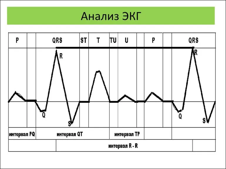 Когда необходимо провести анализ ЭКГ