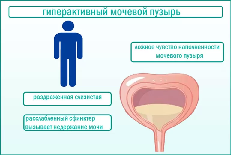 Заболевания мочевыделительной системы