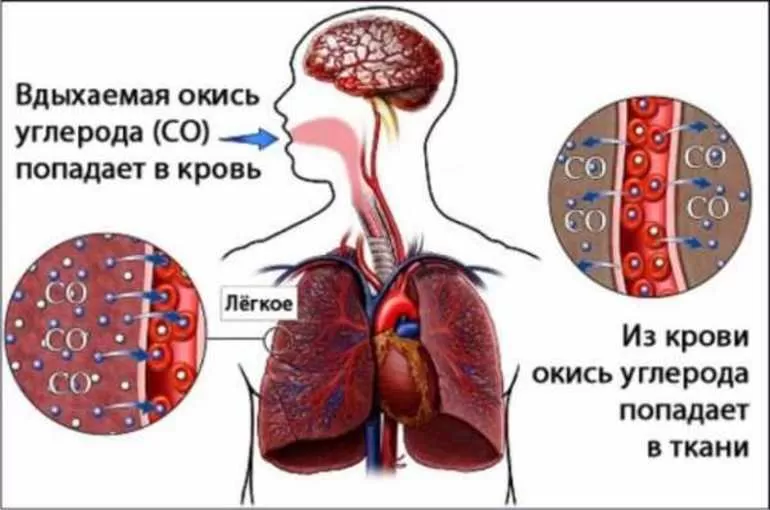 При отравлении метаном