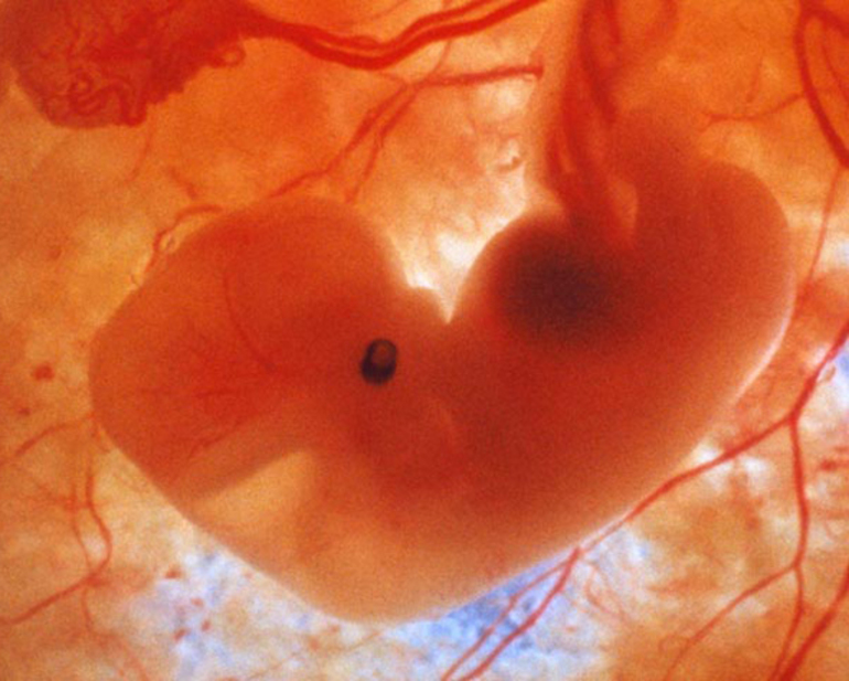  критические периоды эмбриогенеза 