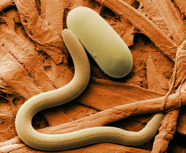  характеристика круглых червей 