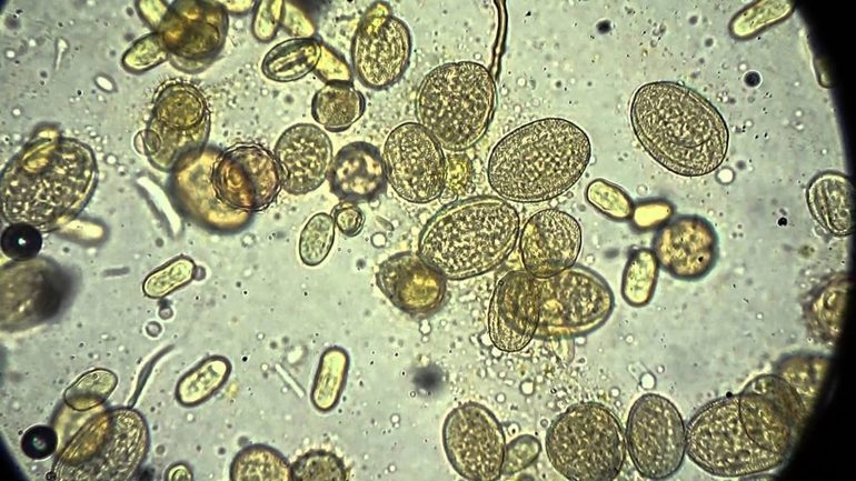Пыльца в микроскопе