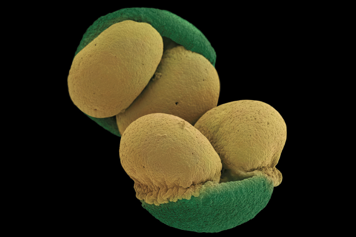 Гены пыльцы. Пыльца сосны микрофотография. Пыльца сосны микроскоп. Пыльцевое зерно сосны. Микрофотография пыльцы покрытосеменных.